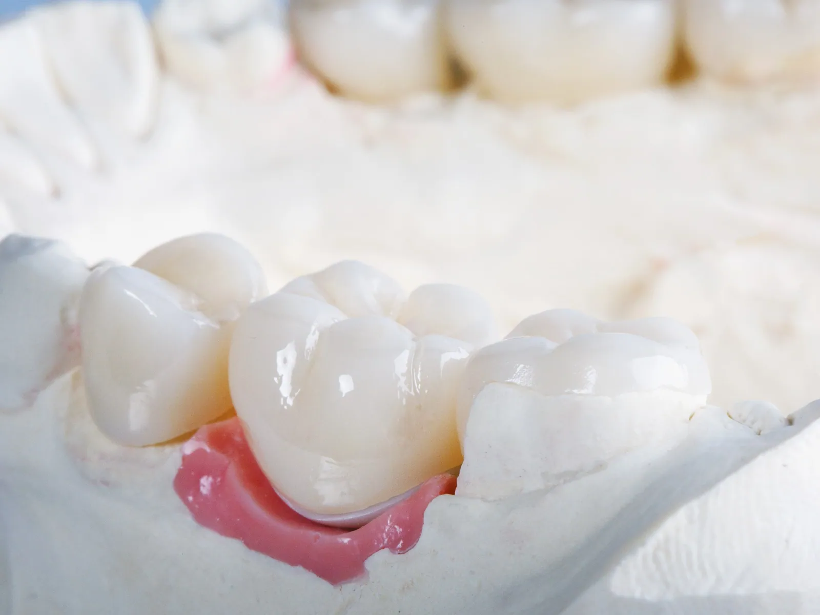 Dental crown consultation and restoration in Woodridge