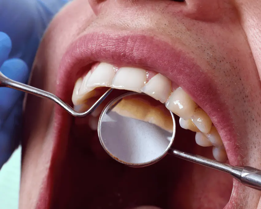 Dental exam and cleaning appointment at Urban Dental Care in Woodridge