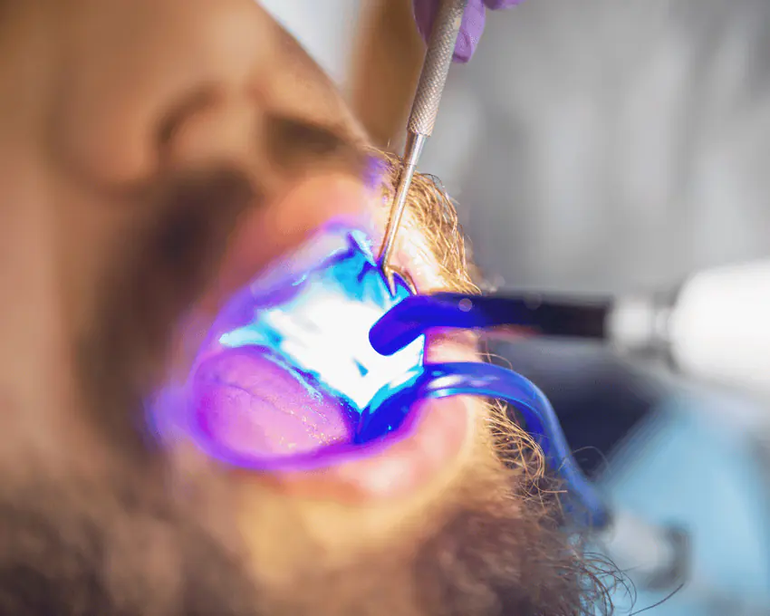 Tooth-colored dental restoration treatment in Woodridge