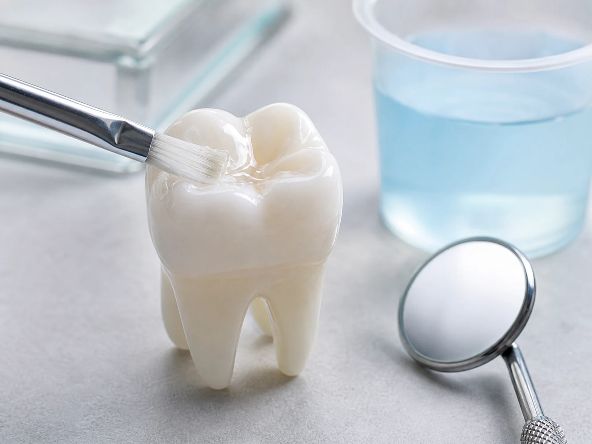 Fluoride varnish brush applying a thin coating to a tooth model