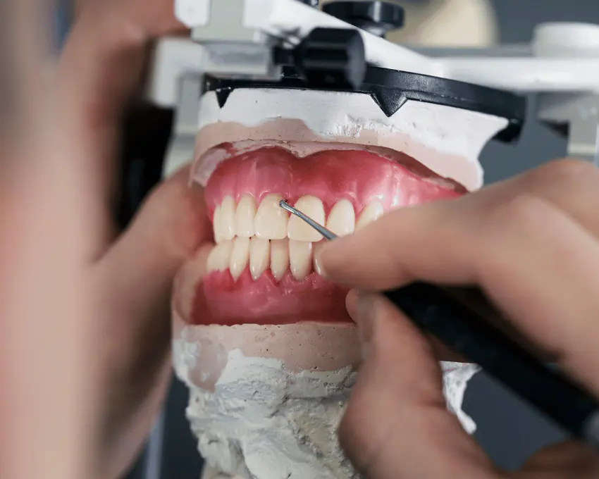 Dental crown bridge and prosthodontic care in Woodridge